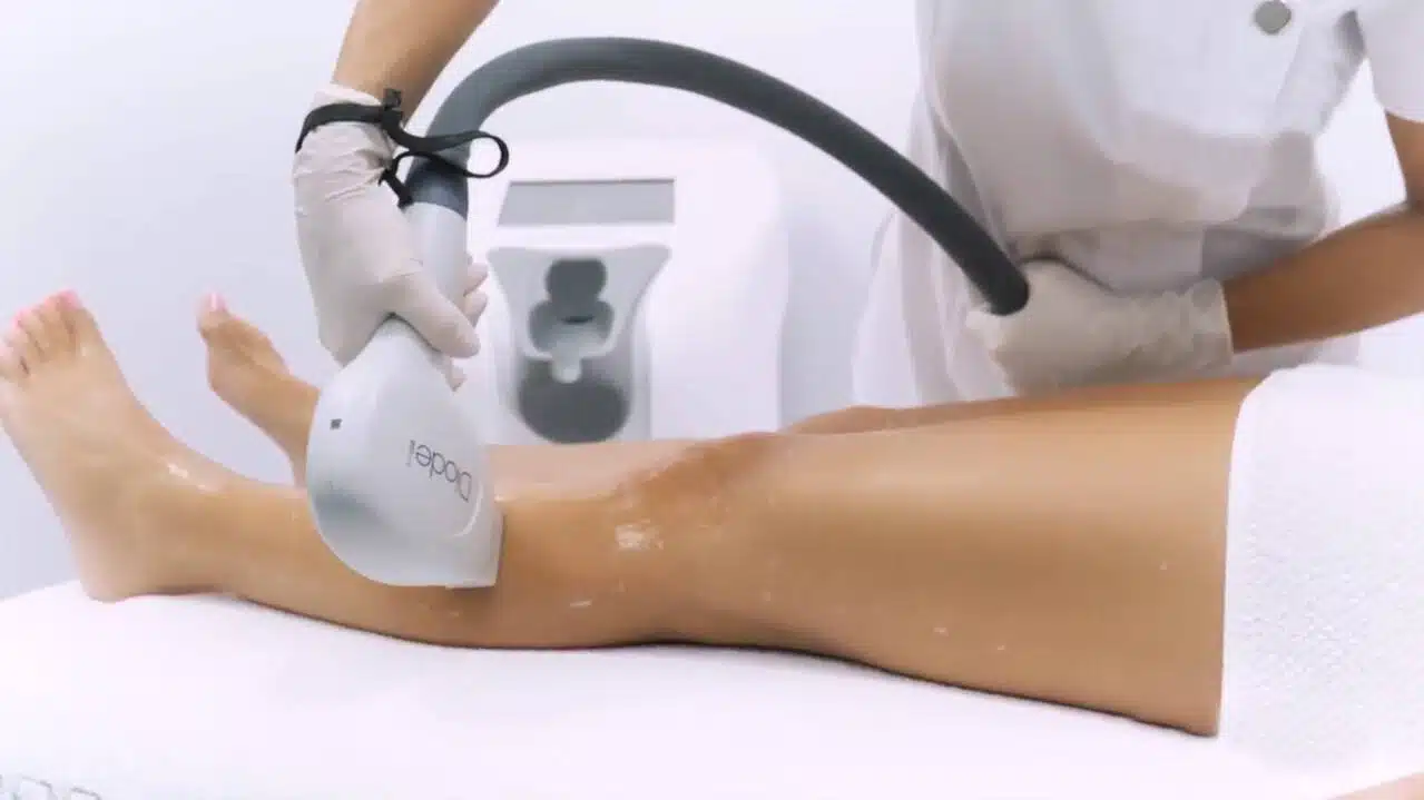 Epilare definitiva inghinal: câte ședințe, preț și pregătire (Ghid 2026) 3 Aplicarea unei creme calmante pe piele după o ședință de epilare definitivă inghinală